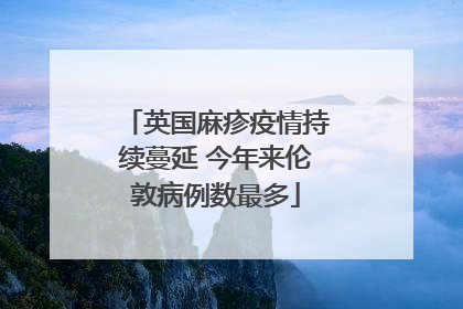 英国麻疹疫情持续蔓延 今年来伦敦病例数最多